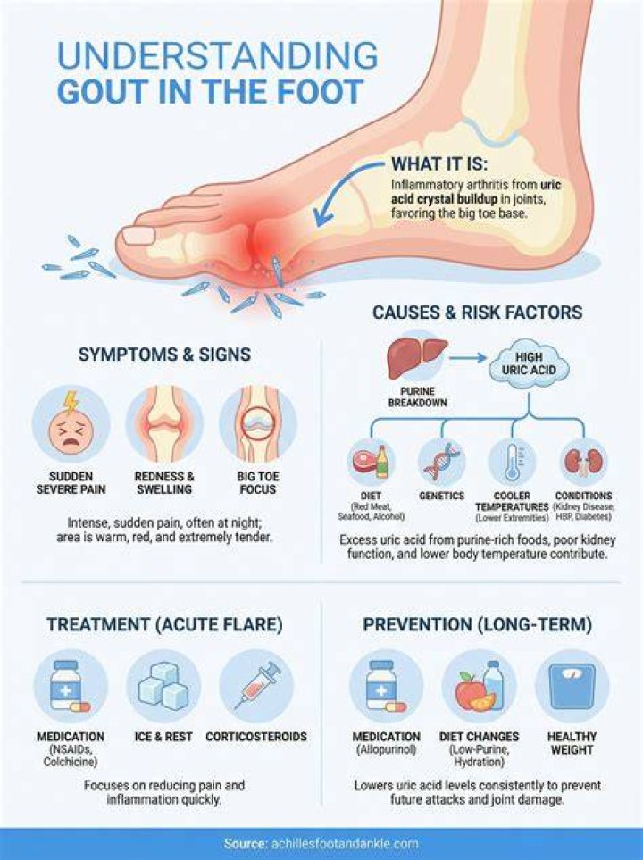 Common Gout Symptoms and How to Prevent Them